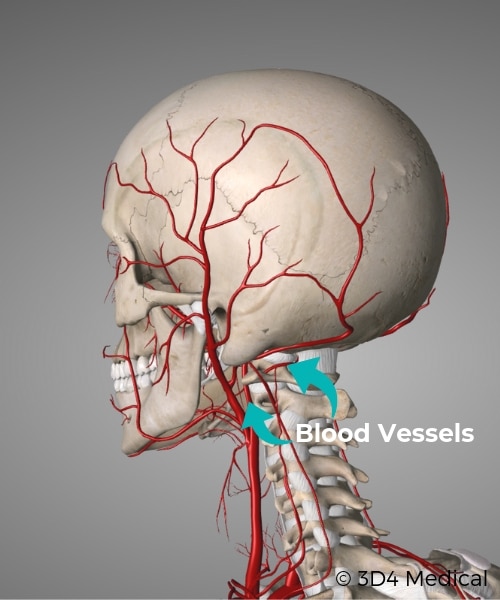 Blood vessel causes of headaches