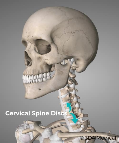 Cervical Spine Discs