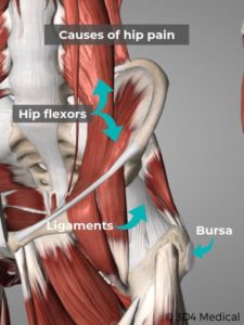 Hip Pain Causes & Treatment - Geelong Osteopaths