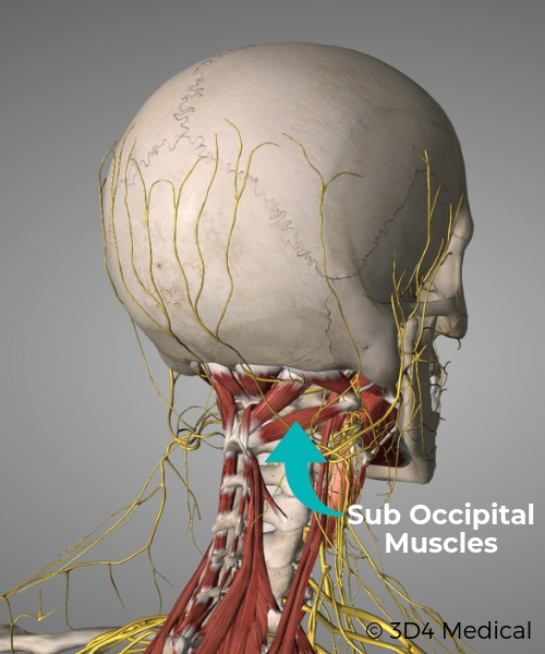 Headache Treatment & Relief - Geelong Osteopaths