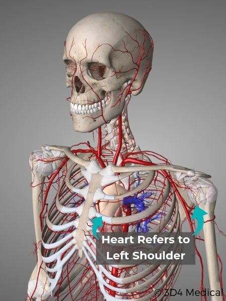 Heart Shoulder Referral