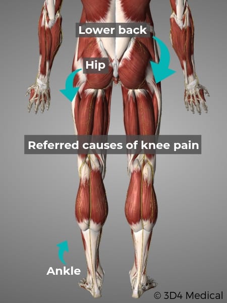 Knee Pain Symptoms and Treatment - Geelong Osteopaths