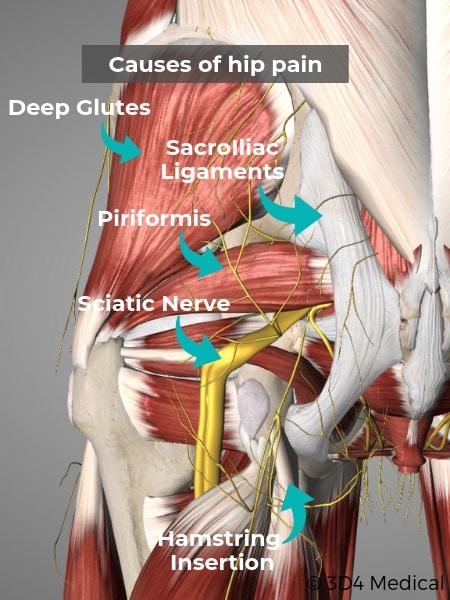 Hip Pain Causes Treatment Geelong Osteopaths