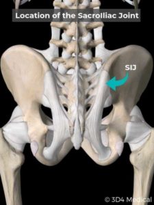 Sacroiliac Joint Dysfunction - Geelong Osteopaths